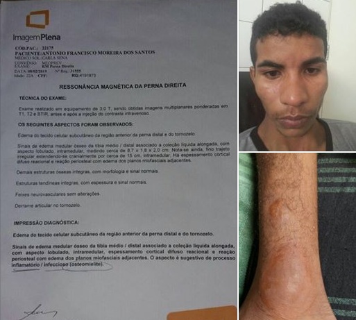 Jovem com doença rara precisa de ajuda para fazer tratamento
